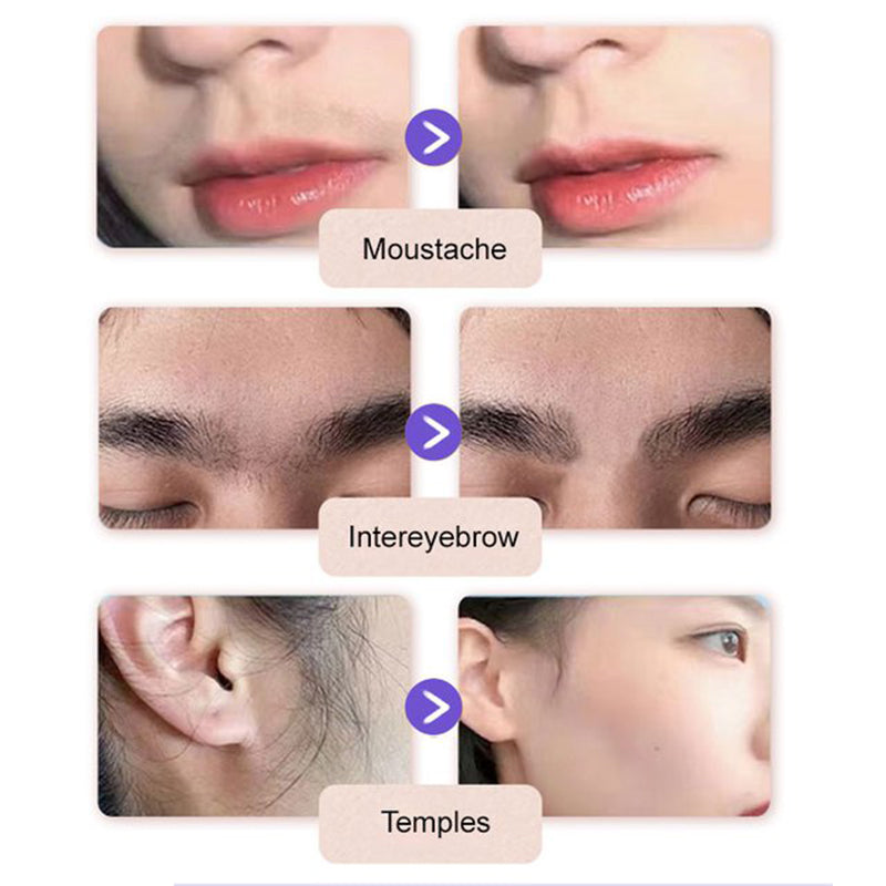 💗Last Day Special Price £7.99 ! 🔥Buy 2 Get 1 Free🔥Gentle and Painless Facial Hair Removal Cream
