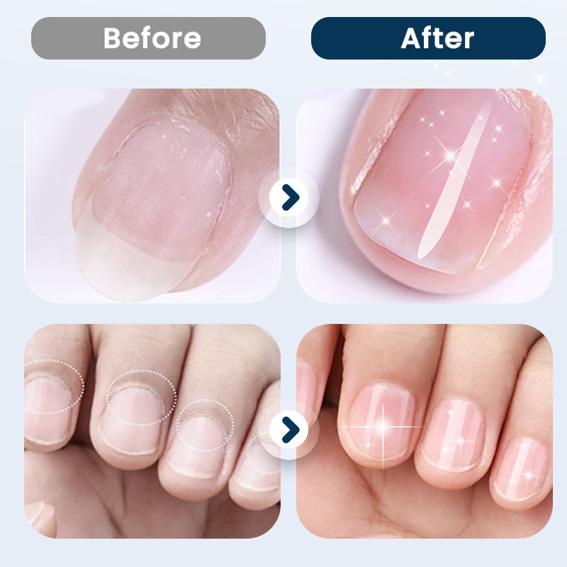 Nourishing Nail Repair Spray